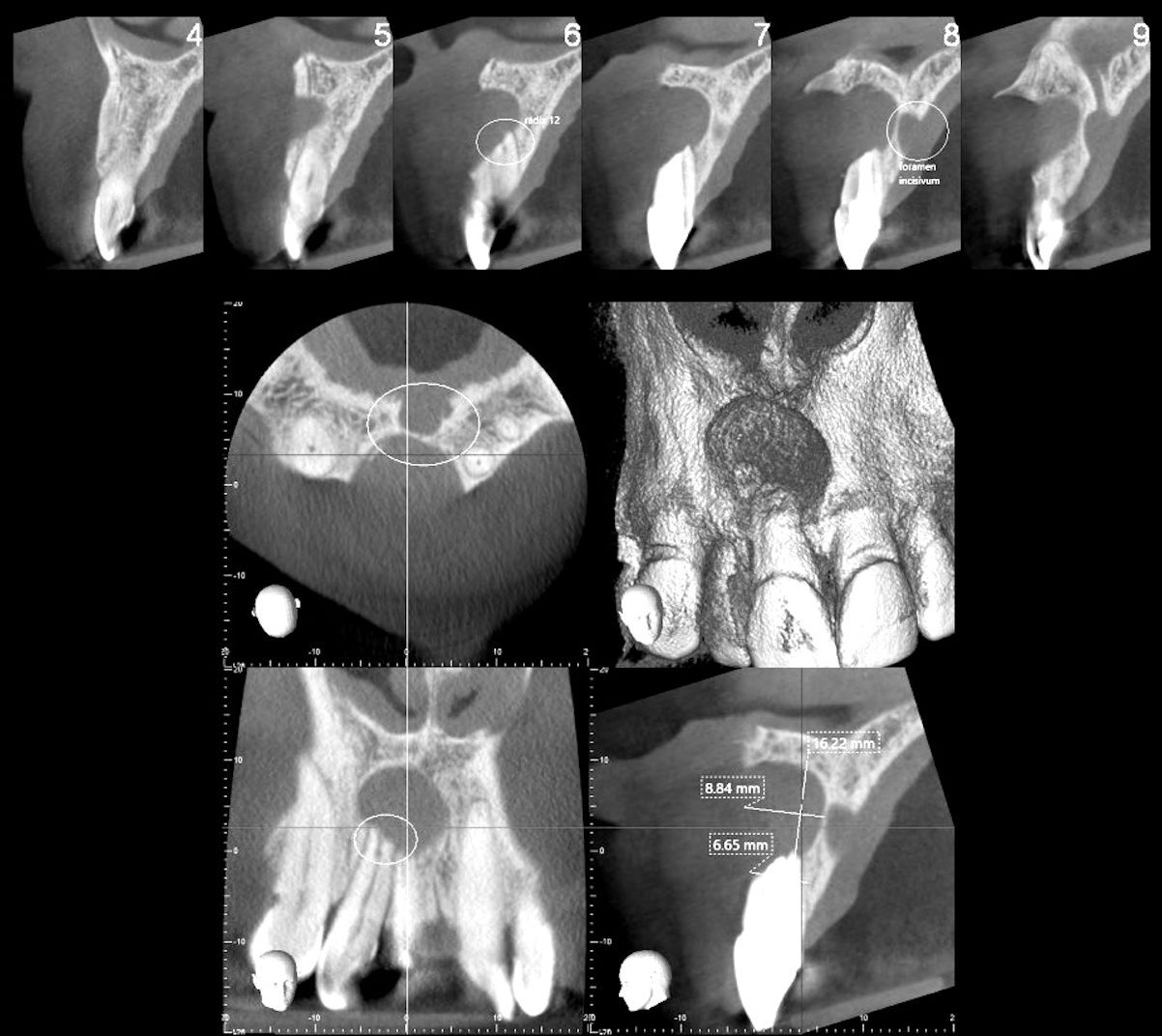The CBCT scan in several cross-sections